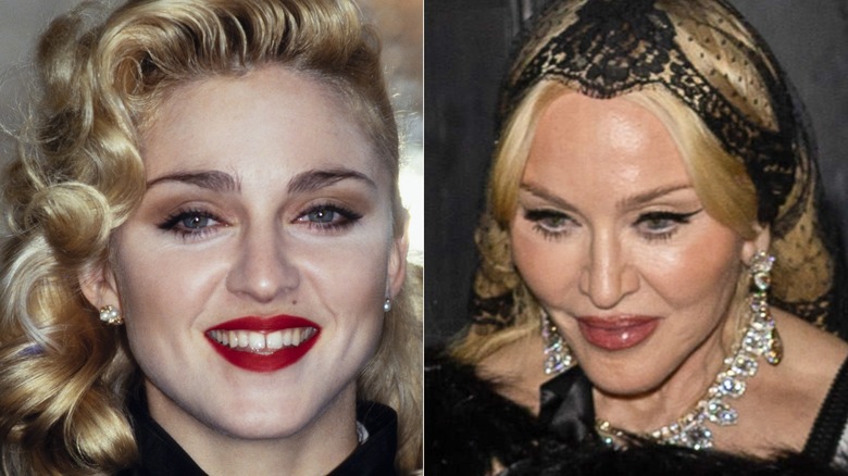 plastic surgery madonna