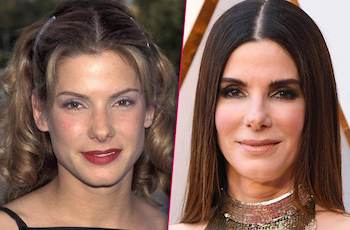 sandra bullock surgery plastic
